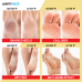 AirFit Medi Peach Exfoliation Foot Mask - 1 pair